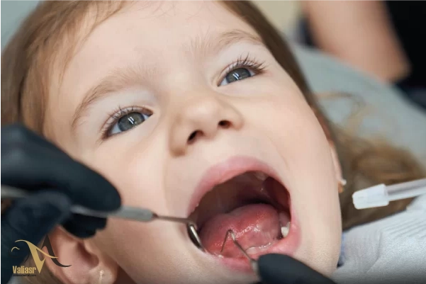 کودکان از چه سنی باید برای اولین بار به دندان‌پزشک مراجعه کنند؟